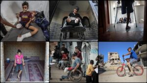 6 000 amputees need urgent long-term rehabilitation in Gaza, Health Ministry says